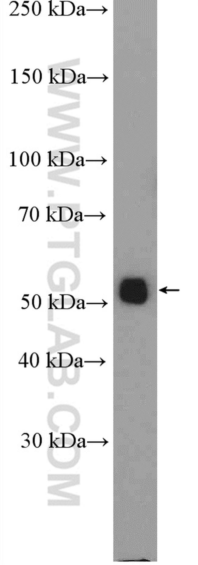 ALG11 Antibody in Western Blot (WB)