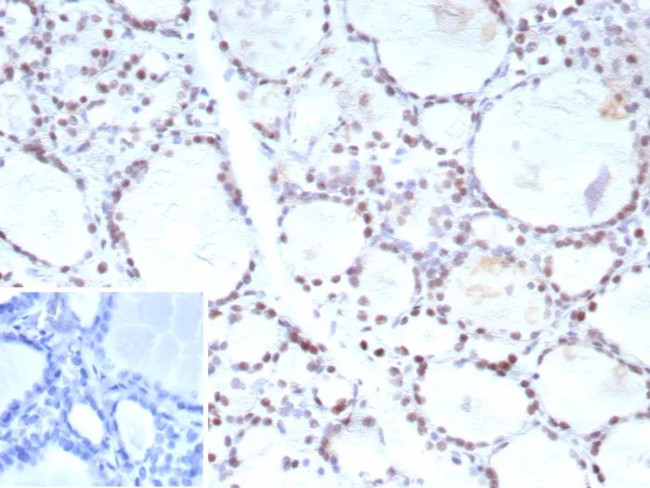 FOXP1 (Transcription Factor) Antibody in Immunohistochemistry (Paraffin) (IHC (P))