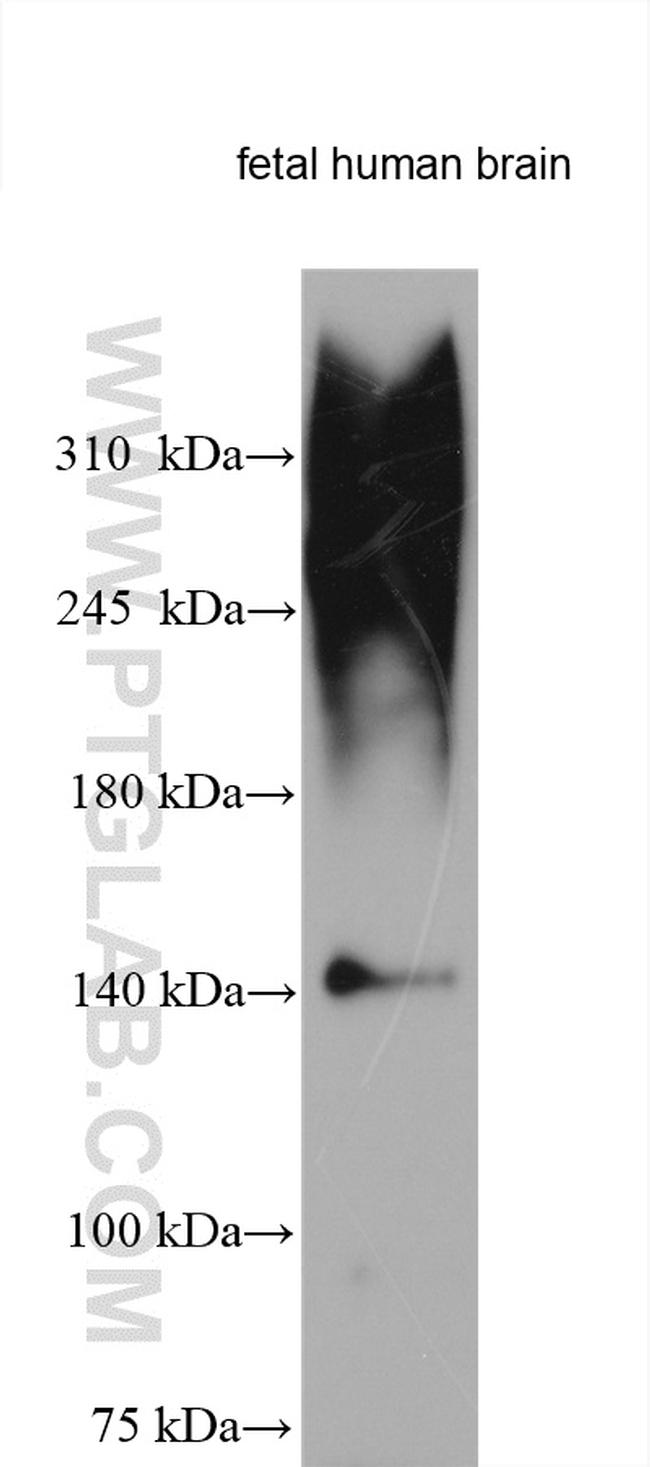 Neurocan Antibody in Western Blot (WB)