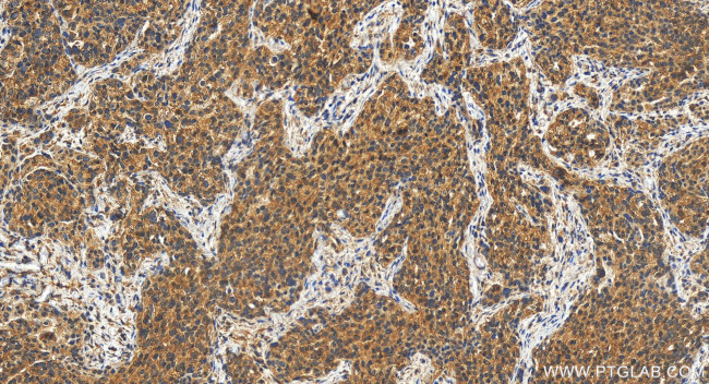 ECHDC3 Antibody in Immunohistochemistry (Paraffin) (IHC (P))