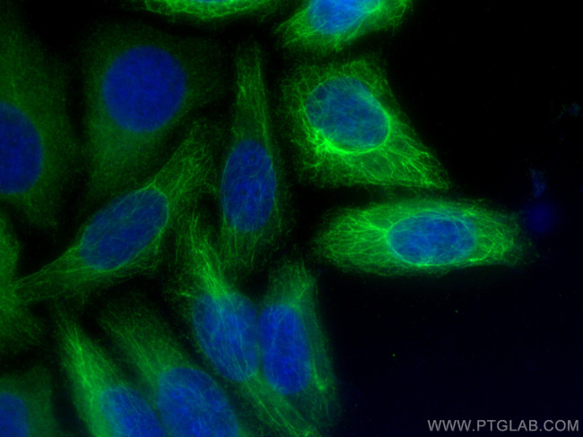 Cytokeratin 8 Antibody in Immunocytochemistry (ICC/IF)
