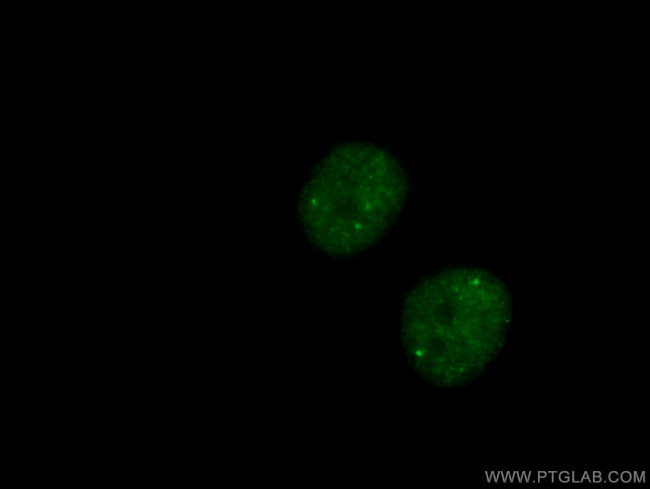 CCDC124 Antibody in Immunocytochemistry (ICC/IF)