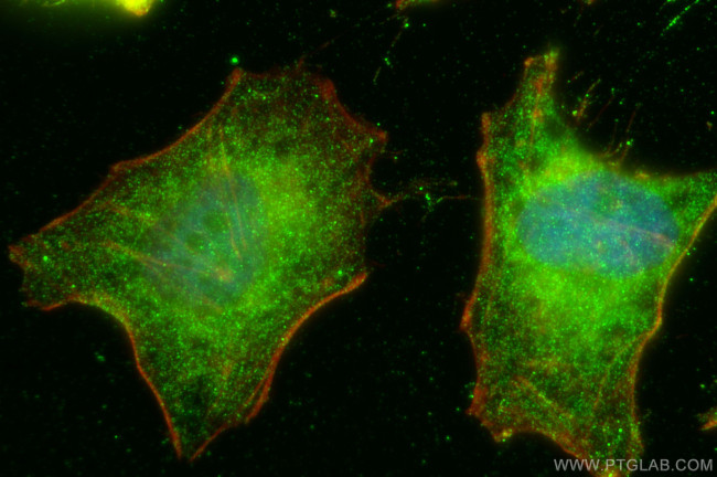 MT1A Antibody in Immunocytochemistry (ICC/IF)