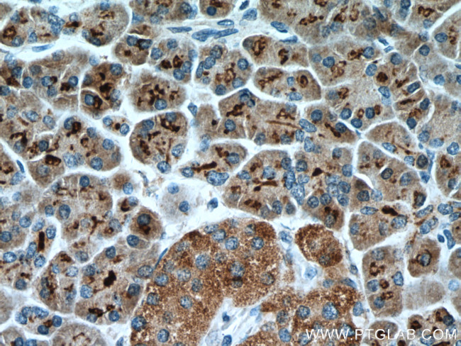 FAM3B Antibody in Immunohistochemistry (Paraffin) (IHC (P))