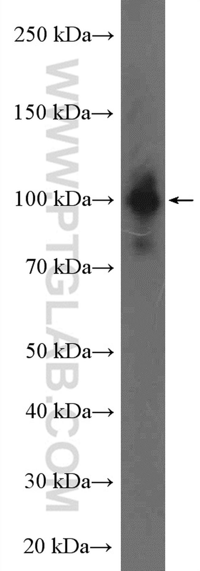 Nesprin 3 Antibody in Western Blot (WB)
