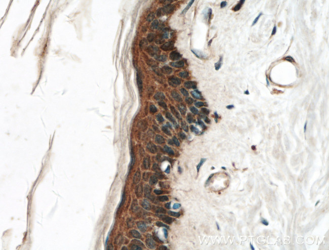 EGF Antibody in Immunohistochemistry (Paraffin) (IHC (P))