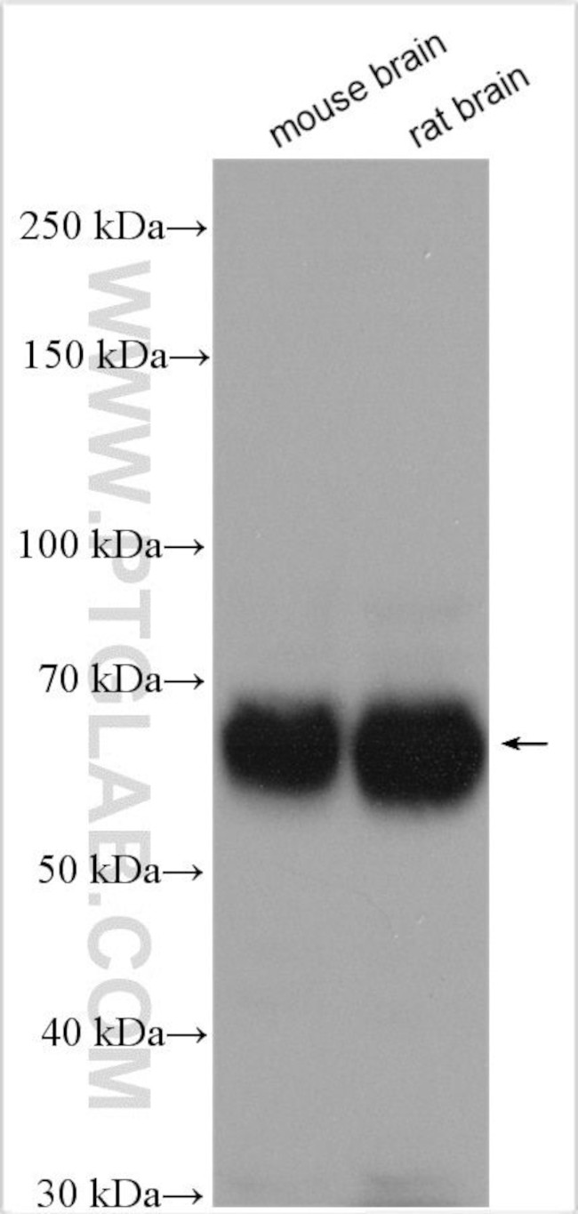 Nogo receptor Antibody in Western Blot (WB)