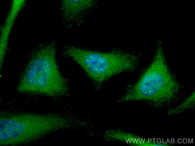 NEK1 Antibody in Immunocytochemistry (ICC/IF)