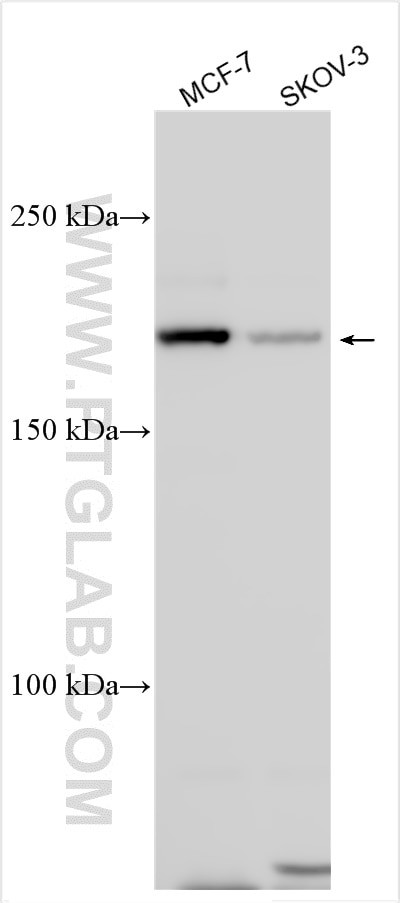 TET3 Antibody in Western Blot (WB)