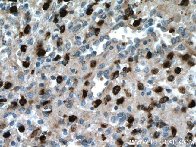 PRTN3 Antibody in Immunohistochemistry (Paraffin) (IHC (P))