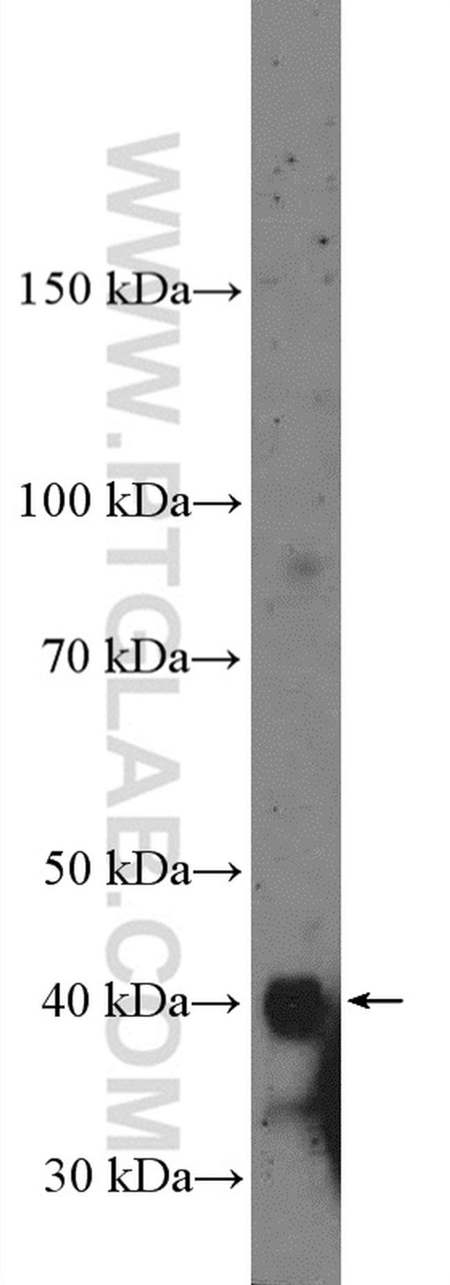 ZFPL1 Antibody in Western Blot (WB)