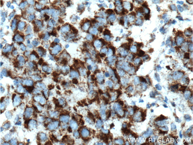 TBXA2R Antibody in Immunohistochemistry (Paraffin) (IHC (P))