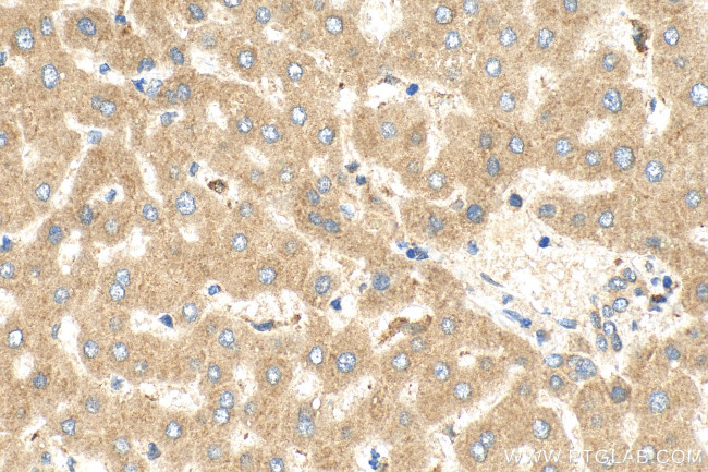CPN2 Antibody in Immunohistochemistry (Paraffin) (IHC (P))