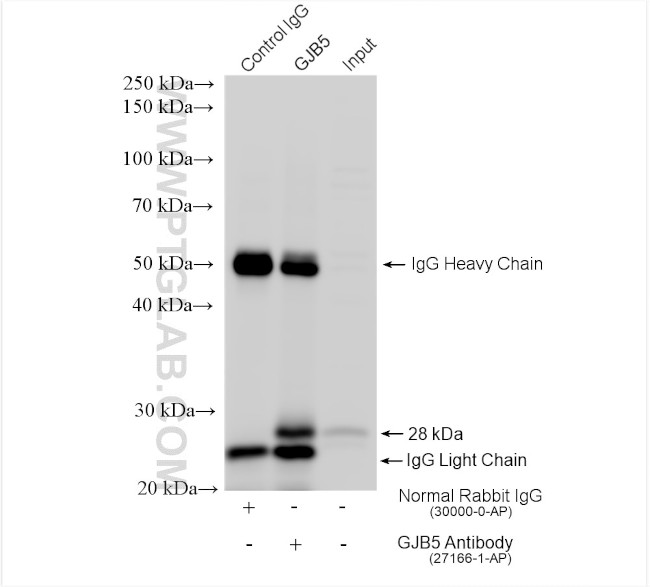 GJB5 Antibody in Immunoprecipitation (IP)