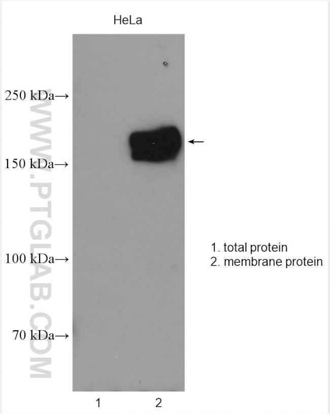 MRP4 Antibody in Western Blot (WB)