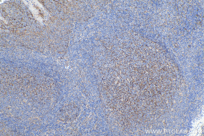 Nectin 2 Antibody in Immunohistochemistry (Paraffin) (IHC (P))