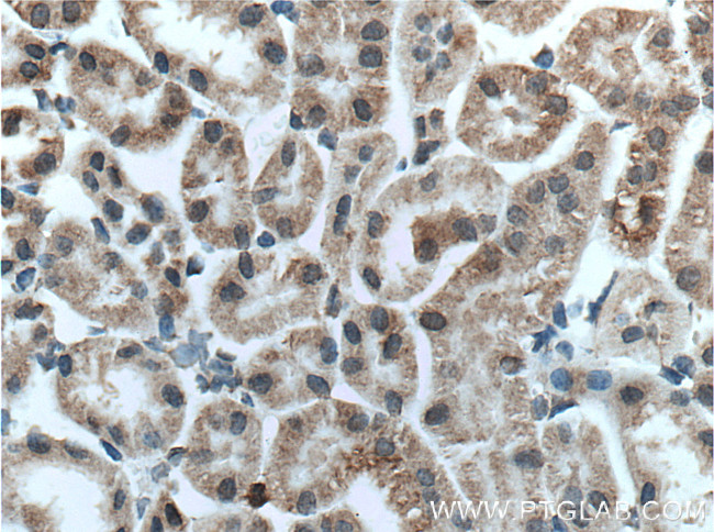 TMIGD1 Antibody in Immunohistochemistry (Paraffin) (IHC (P))