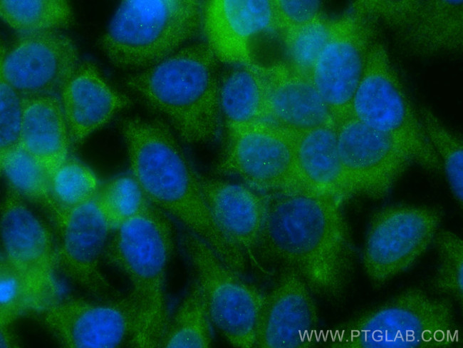 WNT7A Antibody in Immunocytochemistry (ICC/IF)