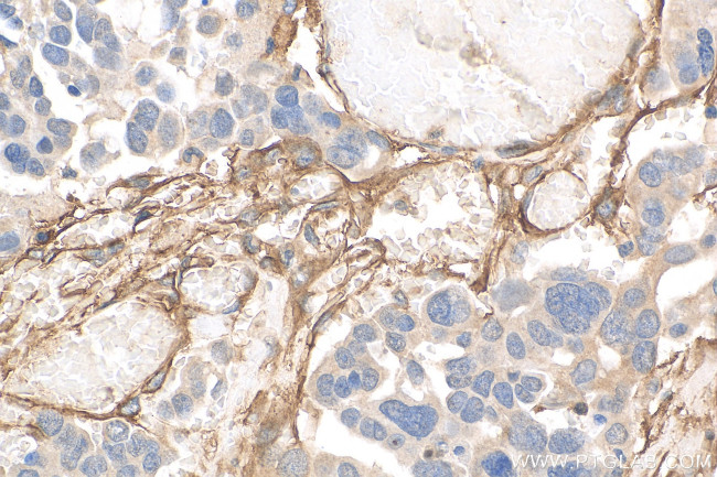 CD90/Thy1 Antibody in Immunohistochemistry (Paraffin) (IHC (P))