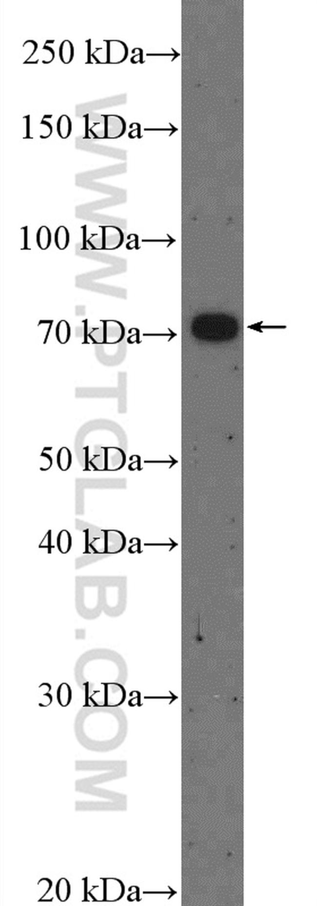 ZDHHC8 Antibody in Western Blot (WB)