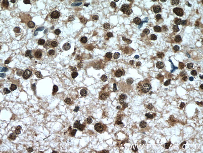 MSI1 Antibody in Immunohistochemistry (Paraffin) (IHC (P))
