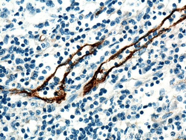 vwf Antibody in Immunohistochemistry (Paraffin) (IHC (P))