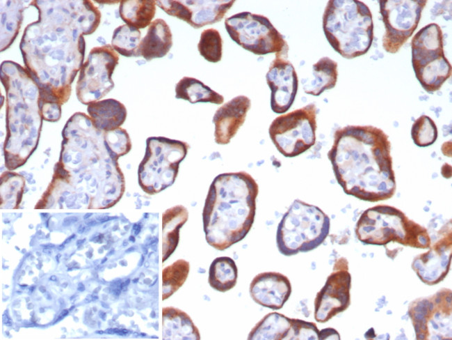 Glypican-3 (GPC3) (Hepatocellular Carcinoma Marker) Antibody in Immunohistochemistry (Paraffin) (IHC (P))
