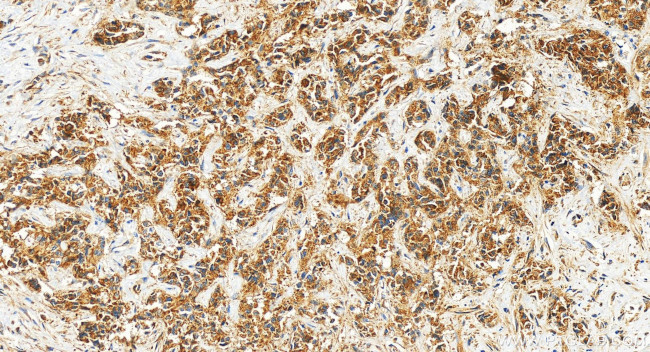 Neuropilin 2 Antibody in Immunohistochemistry (Paraffin) (IHC (P))