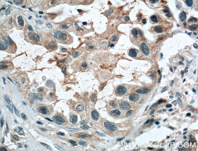 CCDC8 Antibody in Immunohistochemistry (Paraffin) (IHC (P))