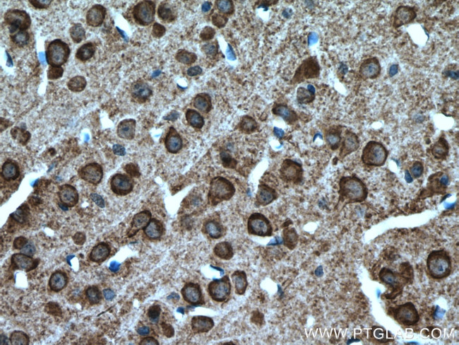 SLC4A10 Antibody in Immunohistochemistry (Paraffin) (IHC (P))