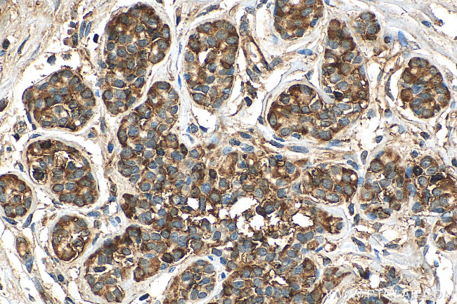 C8G Antibody in Immunohistochemistry (Paraffin) (IHC (P))