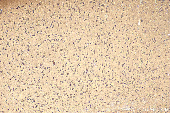 AP4S1 Antibody in Immunohistochemistry (Paraffin) (IHC (P))