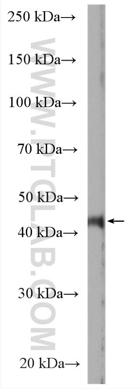 LMBRD1 Antibody in Western Blot (WB)