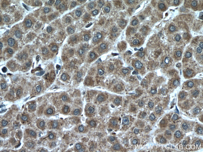 KIF13A Antibody in Immunohistochemistry (Paraffin) (IHC (P))