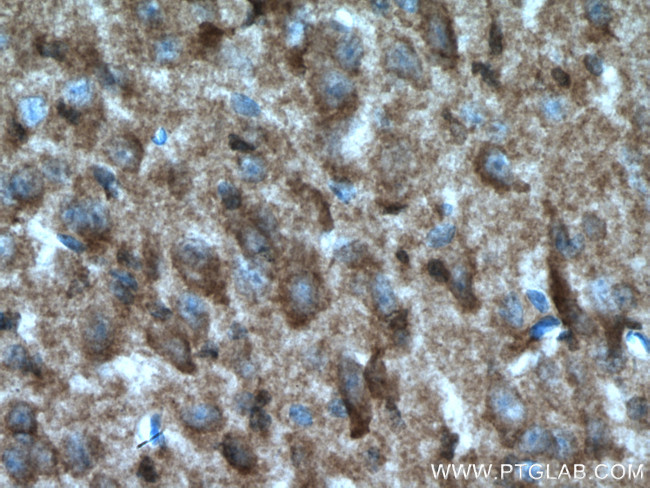 WNT2 Antibody in Immunohistochemistry (Paraffin) (IHC (P))