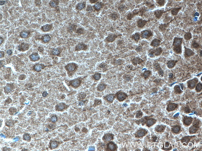 KIF2A Antibody in Immunohistochemistry (Paraffin) (IHC (P))