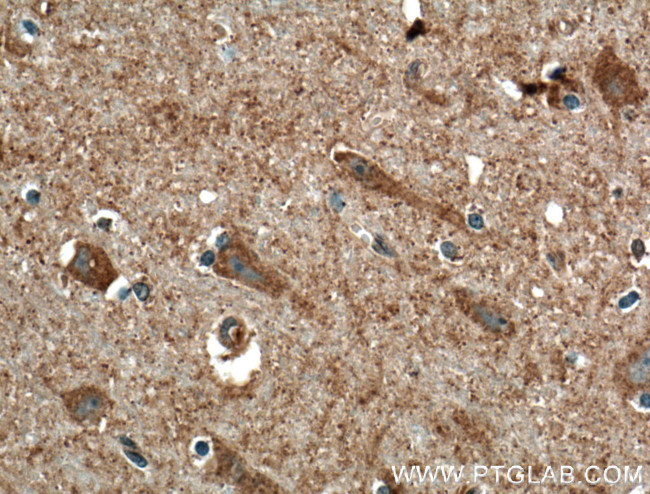 CACNA1E Antibody in Immunohistochemistry (Paraffin) (IHC (P))