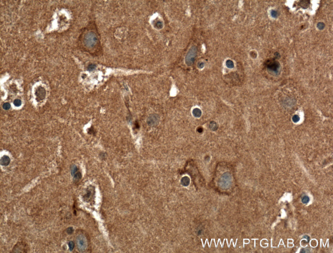 CACNA1A Antibody in Immunohistochemistry (Paraffin) (IHC (P))