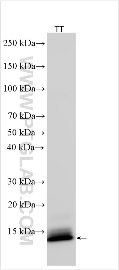 ASXL2 Antibody in Western Blot (WB)