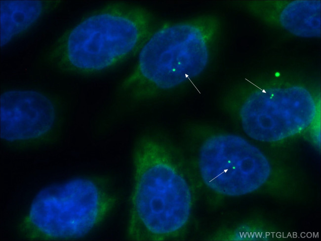 ALMS1 Antibody in Immunocytochemistry (ICC/IF)