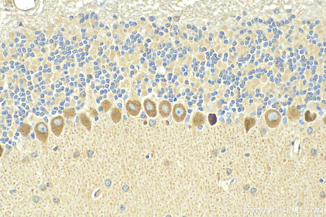 NMDAR1/GRIN1 Antibody in Immunohistochemistry (Paraffin) (IHC (P))