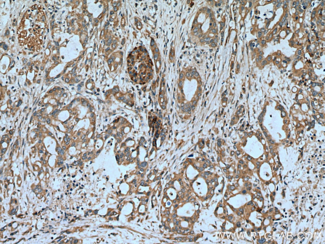 ASIC1 Antibody in Immunohistochemistry (Paraffin) (IHC (P))