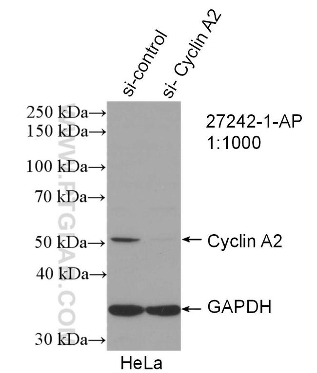 Cyclin A2 Antibody in Western Blot (WB)