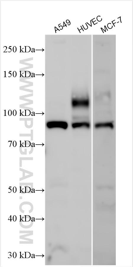 ECE1 Antibody in Western Blot (WB)
