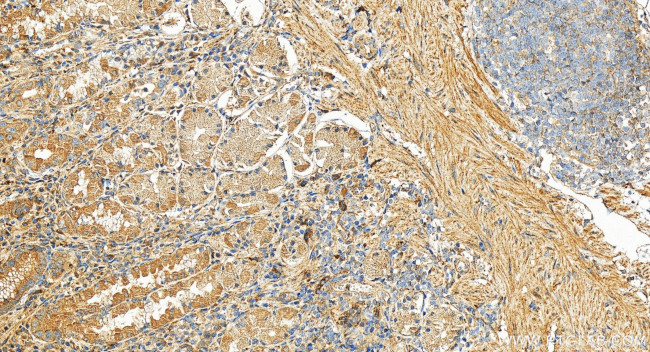 EPDR1 Antibody in Immunohistochemistry (Paraffin) (IHC (P))