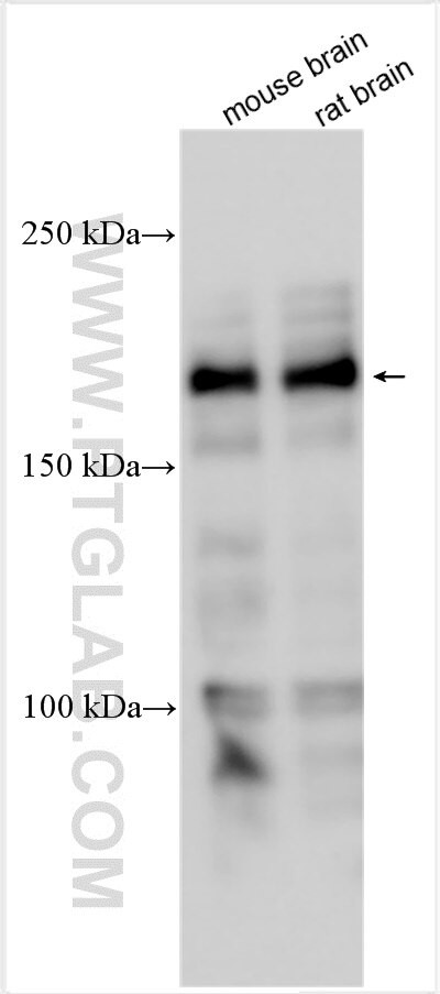 CALCA/CGRP Antibody in Western Blot (WB)