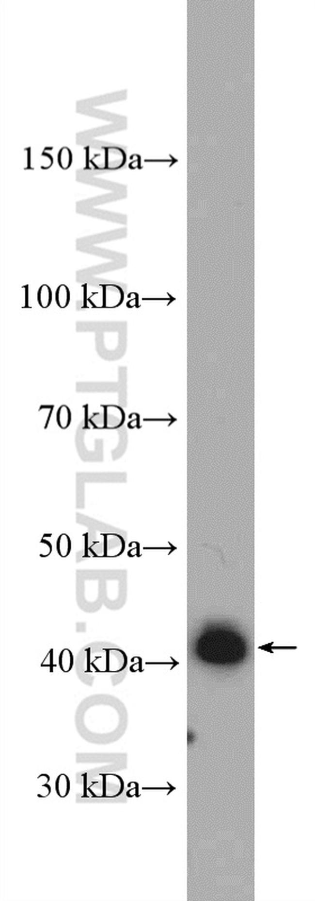 AS3MT Antibody in Western Blot (WB)