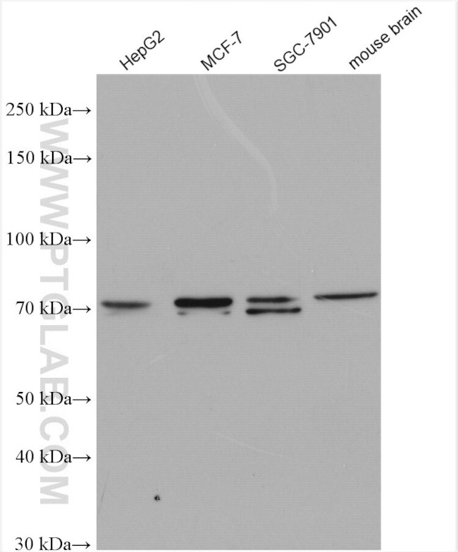 SHANK2 Antibody in Western Blot (WB)