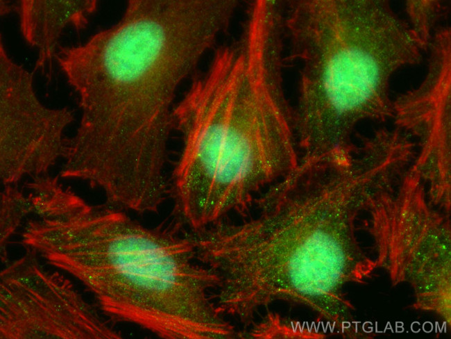 TRIM55 Antibody in Immunocytochemistry (ICC/IF)