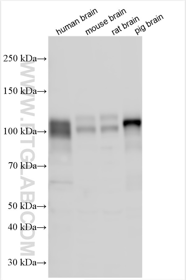 NLGN4X Antibody in Western Blot (WB)